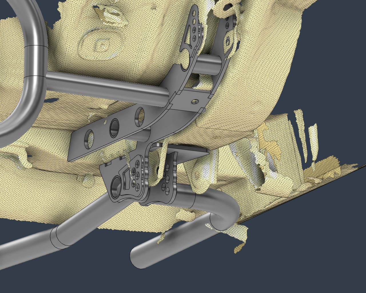 VB-VS PRO RADIAL BODY MOUNT SYSTEM